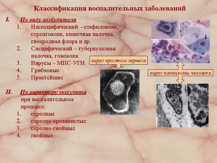 Классификация воспалительных заболеваний I. По виду возбудителя 1. Неспецифический – стафилококк, стрептококк, кишечная палочка,