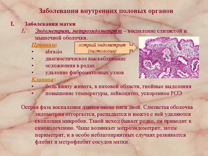 Заболевания внутренних половых органов I. Заболевания матки 1. Эндометрит, метроэндометрит – воспаление слизистой и