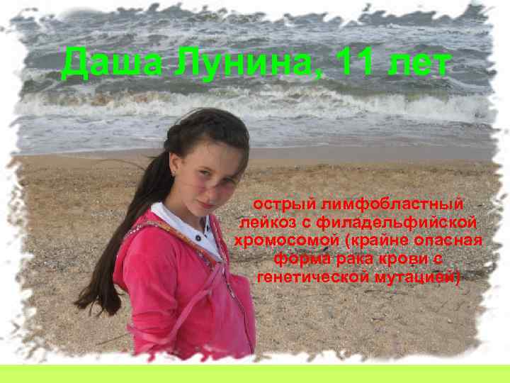 Даша Лунина, 11 лет острый лимфобластный лейкоз с филадельфийской хромосомой (крайне опасная форма рака