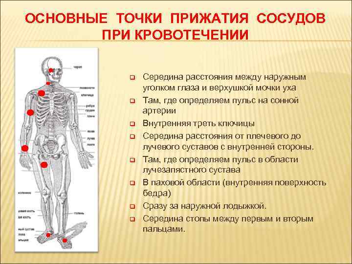 Сколько основных точек прижатия артерий