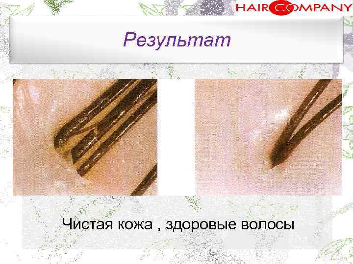 Результат. Чистая кожа , здоровые волосы 