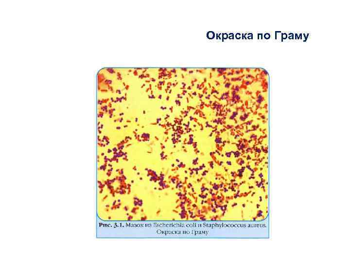 Окраска по Граму 