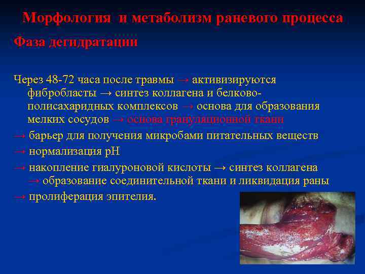 Морфология и метаболизм раневого процесса Фаза дегидратации Через 48 -72 часа после травмы →