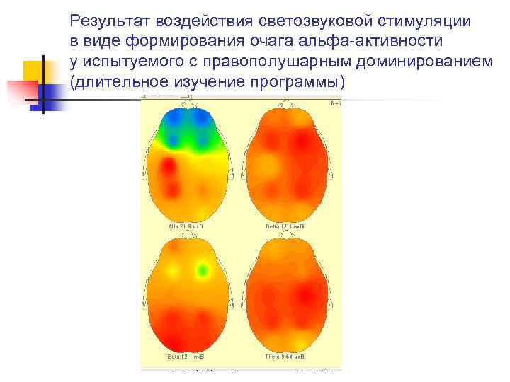 Результат воздействия светозвуковой стимуляции в виде формирования очага альфа-активности у испытуемого с правополушарным доминированием