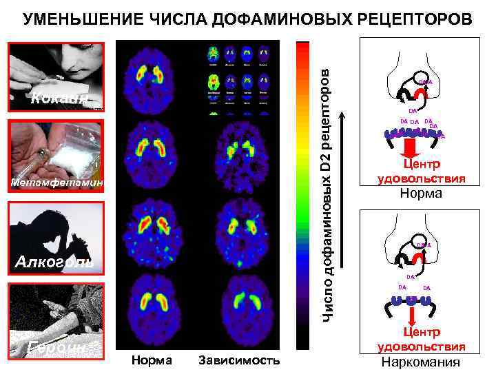 Число дофаминовых D 2 рецепторов УМЕНЬШЕНИЕ ЧИСЛА ДОФАМИНОВЫХ РЕЦЕПТОРОВ Кокаин Метамфетамин Алкоголь Героин Норма