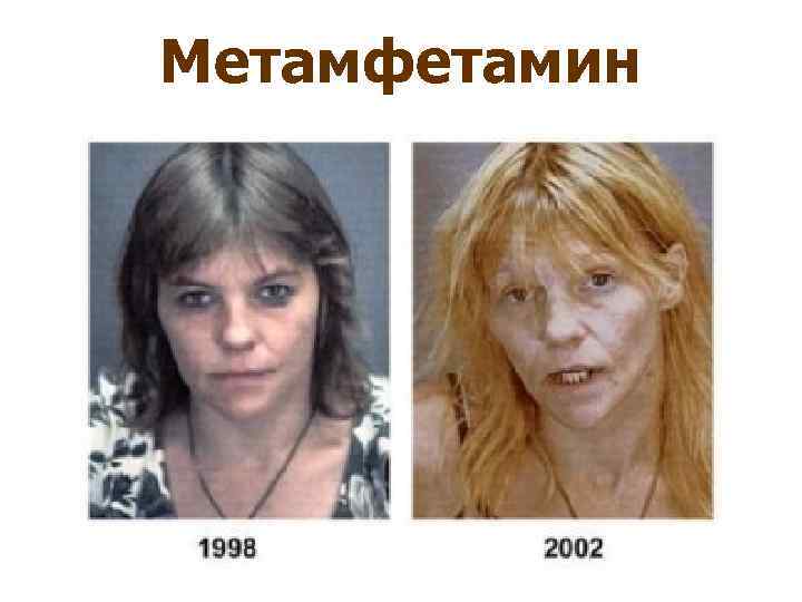 Метамфетамин 