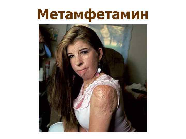 Метамфетамин 