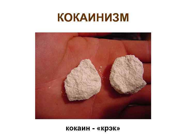 КОКАИНИЗМ кокаин - «крэк» 