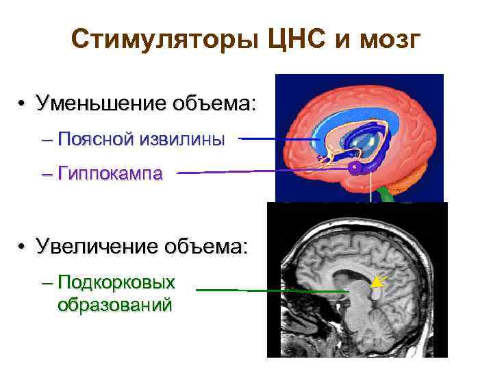 Стимуляторы ЦНС и мозг • Уменьшение объема: – Поясной извилины – Гиппокампа • Увеличение