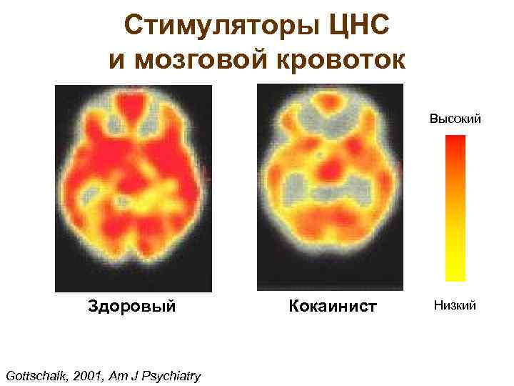 Стимуляторы ЦНС и мозговой кровоток Высокий Здоровый Gottschalk, 2001, Am J Psychiatry Кокаинист Низкий