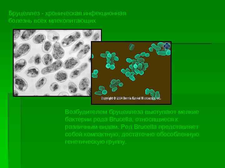 Бруцеллез - хроническая инфекционная болезнь всех млекопитающих Возбудителем бруцеллеза выступают мелкие бактерии рода Brucella,