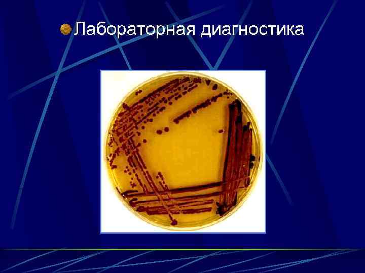 Лабораторная диагностика 