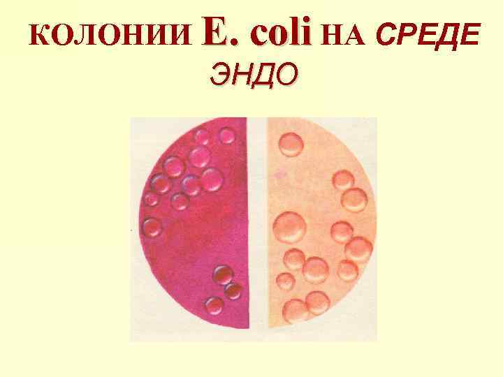 КОЛОНИИ E. coli НА СРЕДЕ ЭНДО 