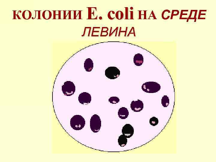 КОЛОНИИ E. coli НА СРЕДЕ ЛЕВИНА 