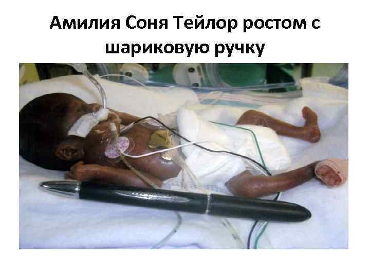 Амилия Соня Тейлор ростом с шариковую ручку 