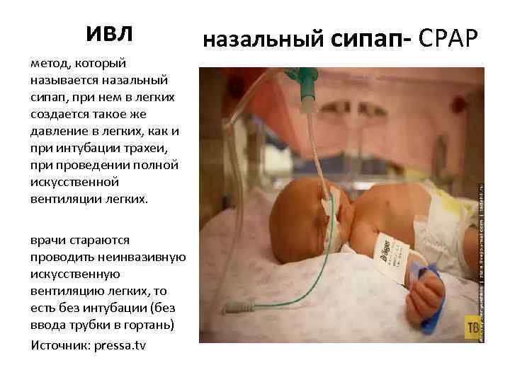 ивл метод, который называется назальный сипап, при нем в легких создается такое же давление