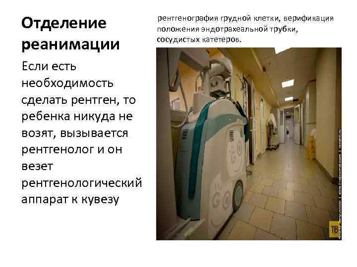 Отделение реанимации рентгенография грудной клетки, верификация положения эндотрахеальной трубки, сосудистых катетеров. Источник: pressa. tv