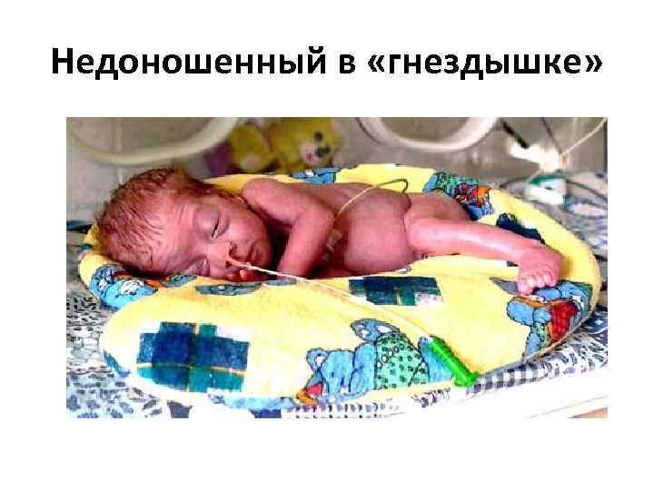 Недоношенный в «гнездышке» 