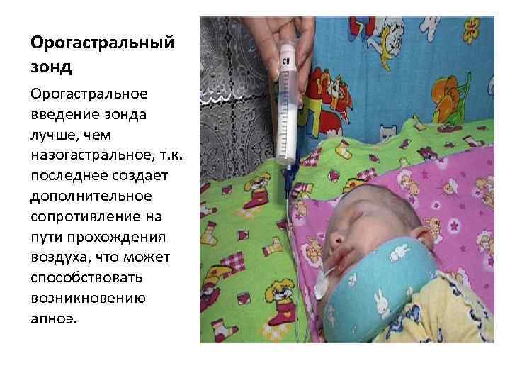 Орогастральный зонд Орогастральное введение зонда лучше, чем назогастральное, т. к. последнее создает дополнительное сопротивление