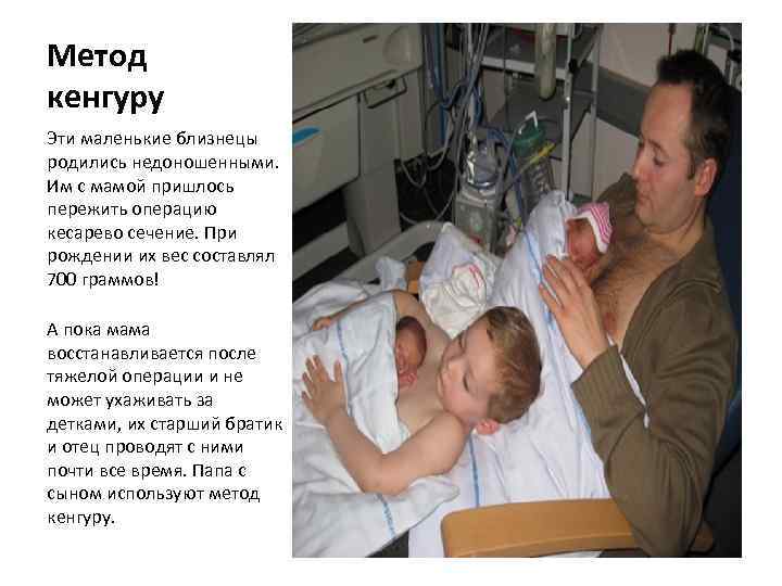 Метод кенгуру Эти маленькие близнецы родились недоношенными. Им с мамой пришлось пережить операцию кесарево