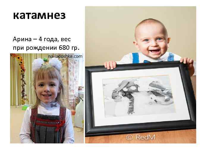 катамнез Арина – 4 года, вес при рождении 680 гр. 