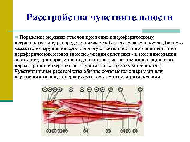 Расстройства чувствительности n Поражение нервных стволов при водит к периферическому невральному типу распределения расстройств