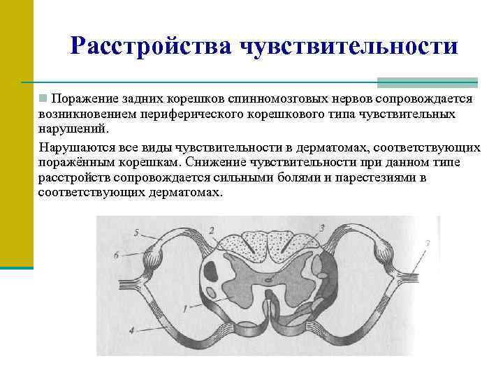 Расстройства чувствительности n Поражение задних корешков спинномозговых нервов сопровождается возникновением периферического корешкового типа чувствительных