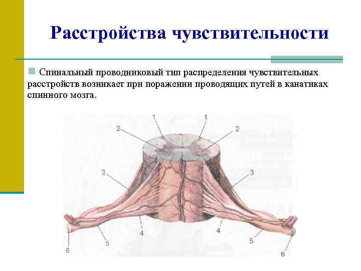 Расстройства чувствительности n Спинальный проводниковый тип распределения чувствительных расстройств возникает при поражении проводящих путей