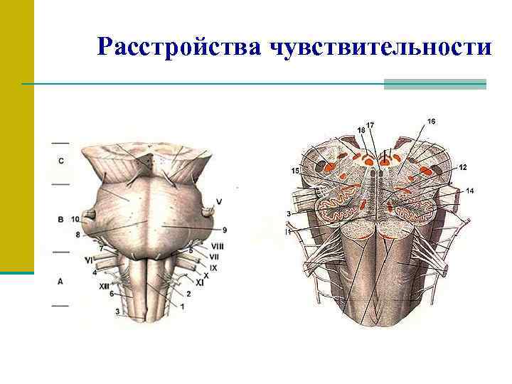 Расстройства чувствительности 