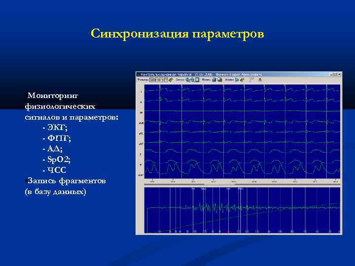 Синхронизация параметров • Мониторинг физиологических сигналов и параметров: - ЭКГ; - ФПГ; - АД;