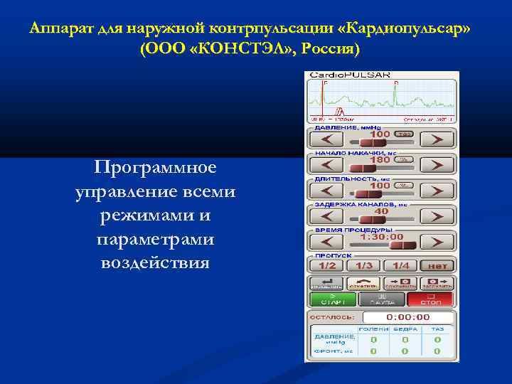 Аппарат для наружной контрпульсации «Кардиопульсар» (ООО «КОНСТЭЛ» , Россия) Программное управление всеми режимами и