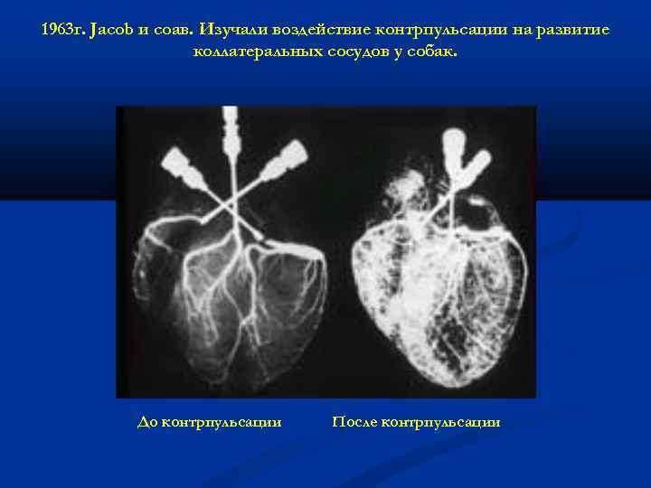 1963 г. Jacob и соав. Изучали воздействие контрпульсации на развитие коллатеральных сосудов у собак.