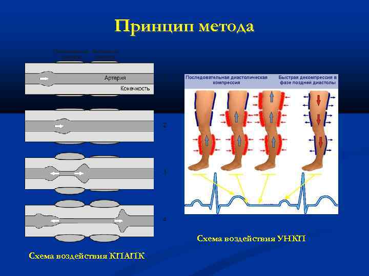 Принцип метода Схема воздействия УНКП Схема воздействия КПАПК 