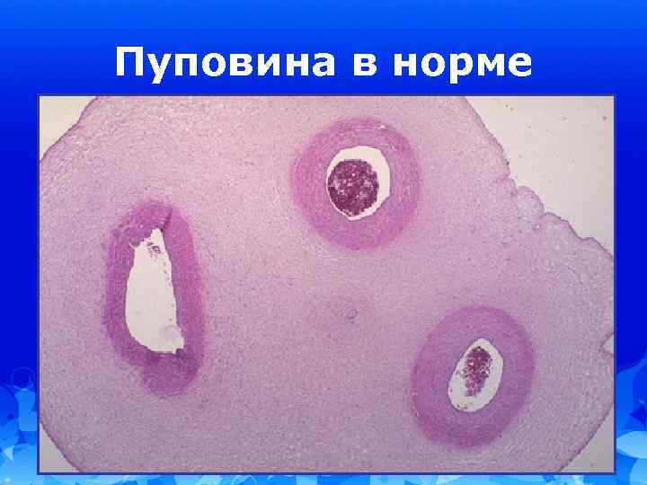 Пуповина в норме 