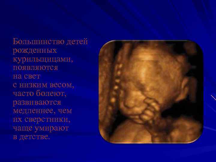 Большинство детей рожденных курильщицами, появляются на свет с низким весом, часто болеют, развиваются медленнее,