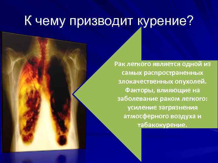 К чему призводит курение? Рак легкого является одной из самых распространенных злокачественных опухолей. Факторы,