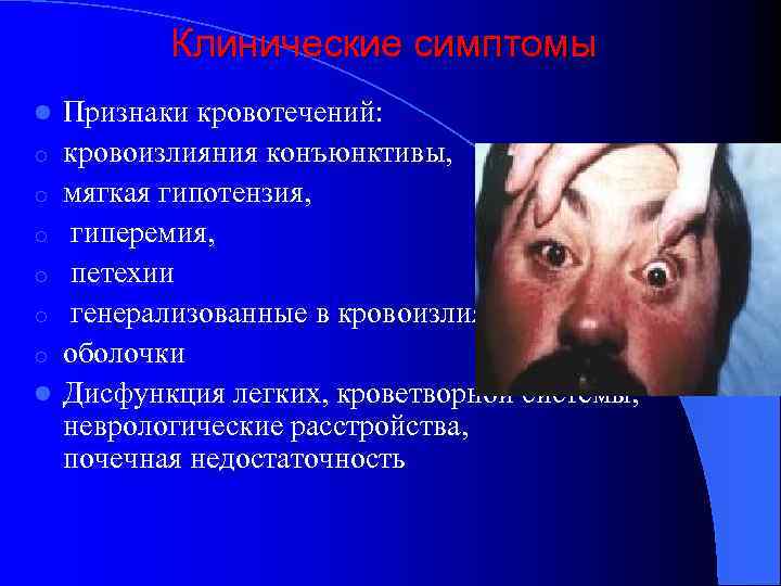 Клинические симптомы l o o o l Признаки кровотечений: кровоизлияния конъюнктивы, мягкая гипотензия, гиперемия,