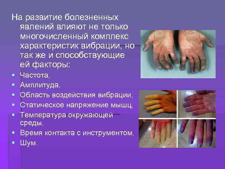 На развитие болезненных явлений влияют не только многочисленный комплекс характеристик вибрации, но так же