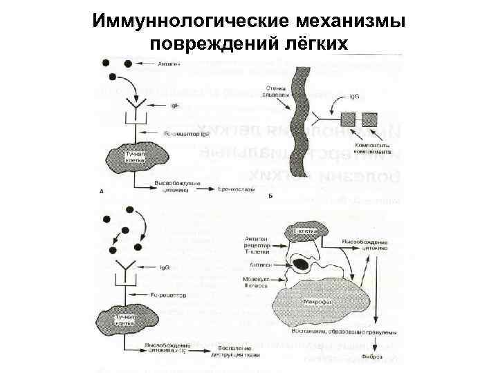 Иммуннологические механизмы повреждений лёгких 