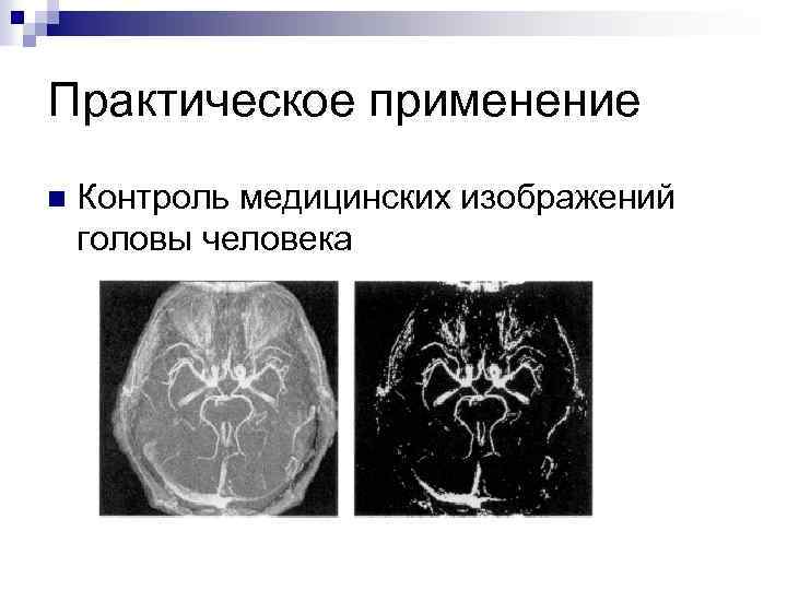 Практическое применение n Контроль медицинских изображений головы человека 