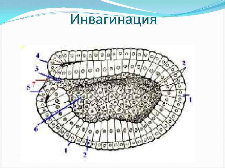 Инвагинация 