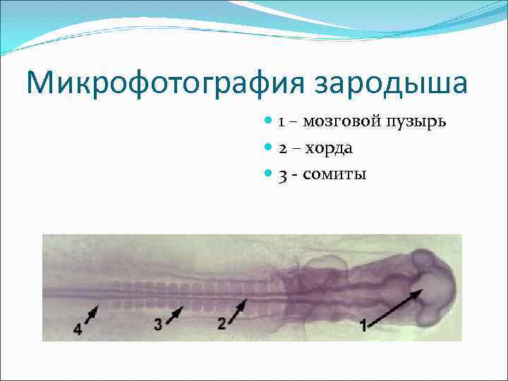 Микрофотография зародыша 1 – мозговой пузырь 2 – хорда 3 - сомиты 