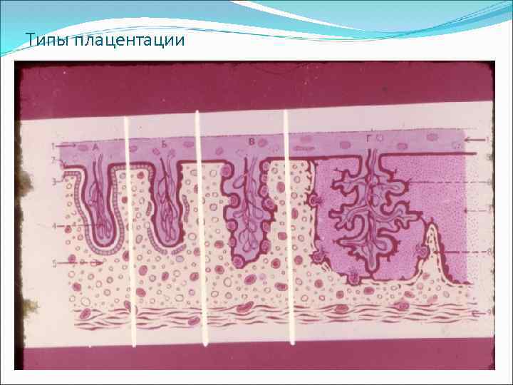 Типы плацентации 