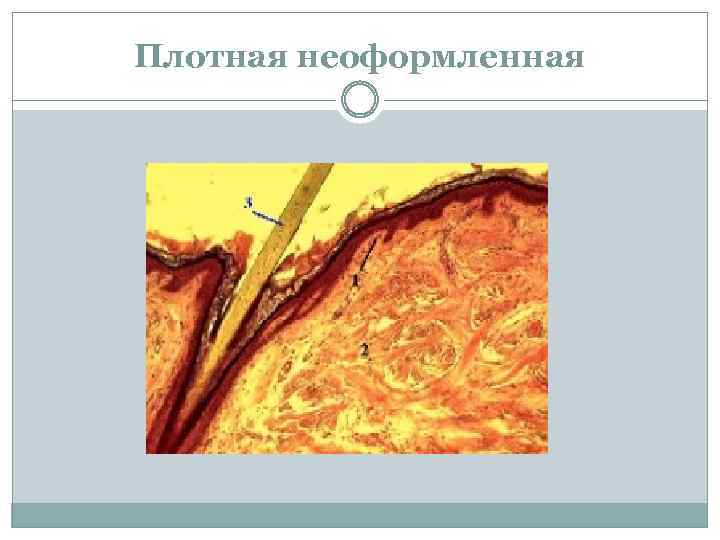 Плотная неоформленная соединительная ткань