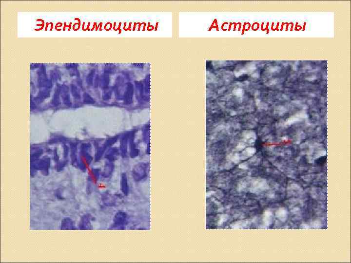 Эпендимоциты Астроциты 