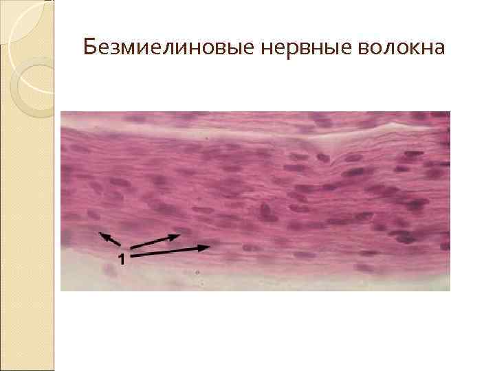 Безмиелиновые нервные волокна 