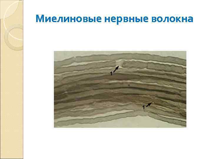 Миелиновые нервные волокна 