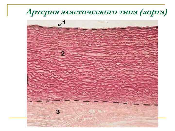 Артерия эластического типа (аорта) 