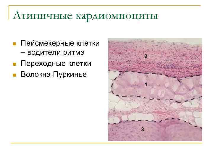 Атипичные кардиомиоциты n n n Пейсмекерные клетки – водители ритма Переходные клетки Волокна Пуркинье