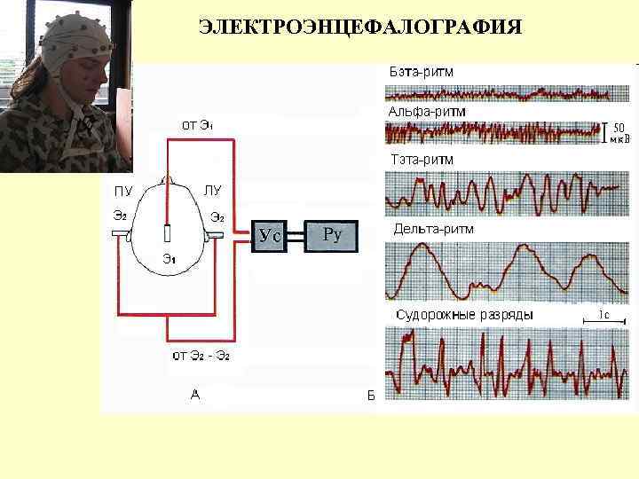 ЭЛЕКТРОЭНЦЕФАЛОГРАФИЯ 